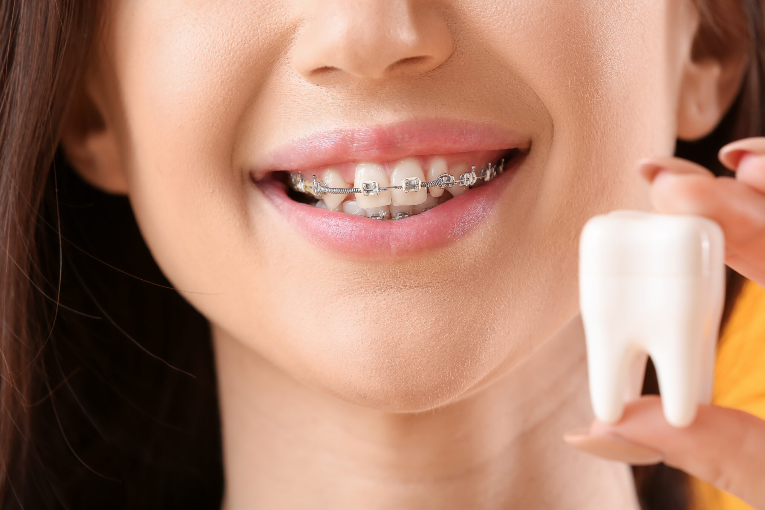 歯列矯正のメリット・デメリットを徹底解説｜種類やセルフチェックの方法もご紹介