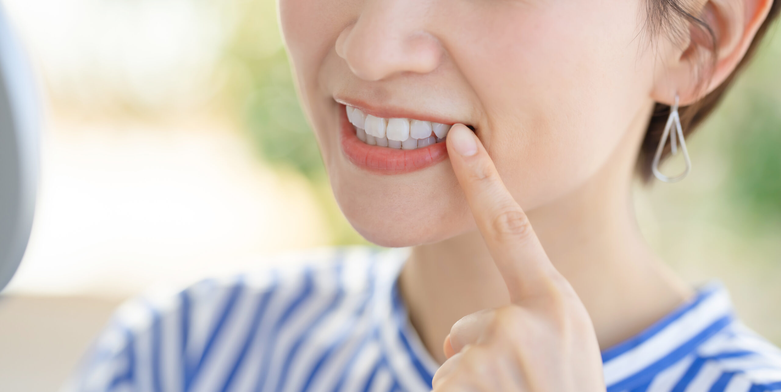 正中ずれはマウスピース矯正で治せる？原因・治療法・費用まで歯科医が徹底解説